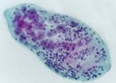 Schistosoma haematobium