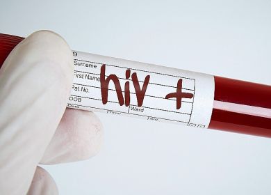 hiv