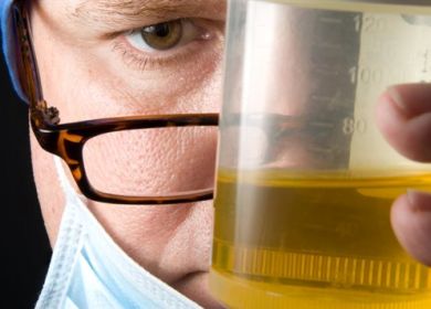 test urine