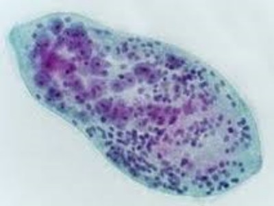 Schistosoma haematobium