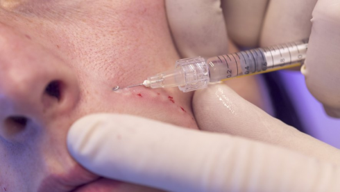 Una seduta di botox si trasforma in un incubo