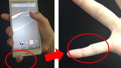 Tenere troppo a lungo il cellulare può far deformare il mignolo?