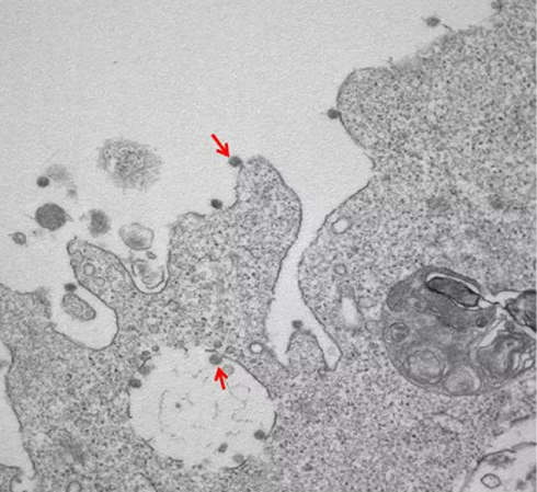 Presentate prime immagini al microscopio del ceppo italiano Sars-CoV-2. 