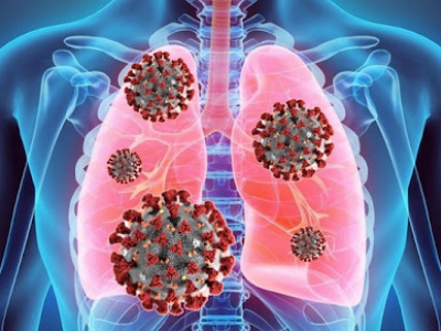 La nuova sindrome da Covid si chiama MIP-C