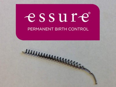 essure