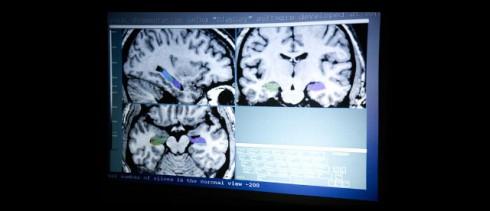 neuroimmaging