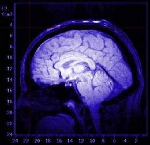 Canada: uno scienziato di alto livello afferma che gli è stato vietato di studiare una misteriosa malattia cerebrale