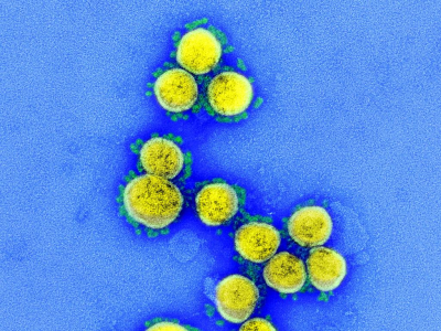 Nuova variante BA.2 più pericolosa di Omicron