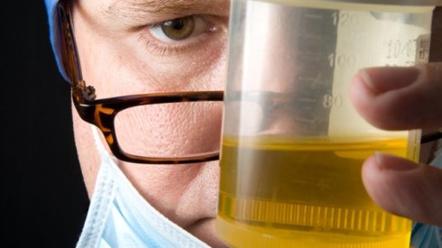 test urine